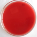 MEDIA BLOOD AGAR PLATE