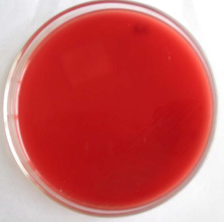 darah-domba-agar-plate-01 MEDIA BLOOD AGAR PLATE