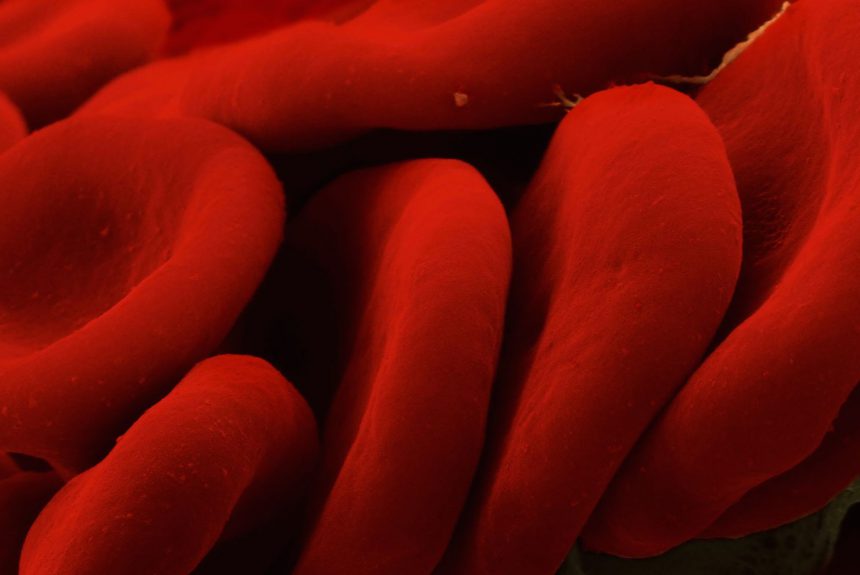 darah-domba-red-blood-cells Dasar Teori Media Agar Darah